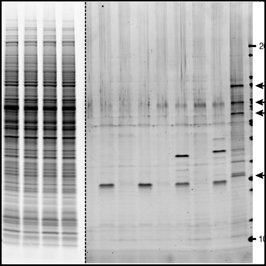 Gel of aggregate-associated proteins